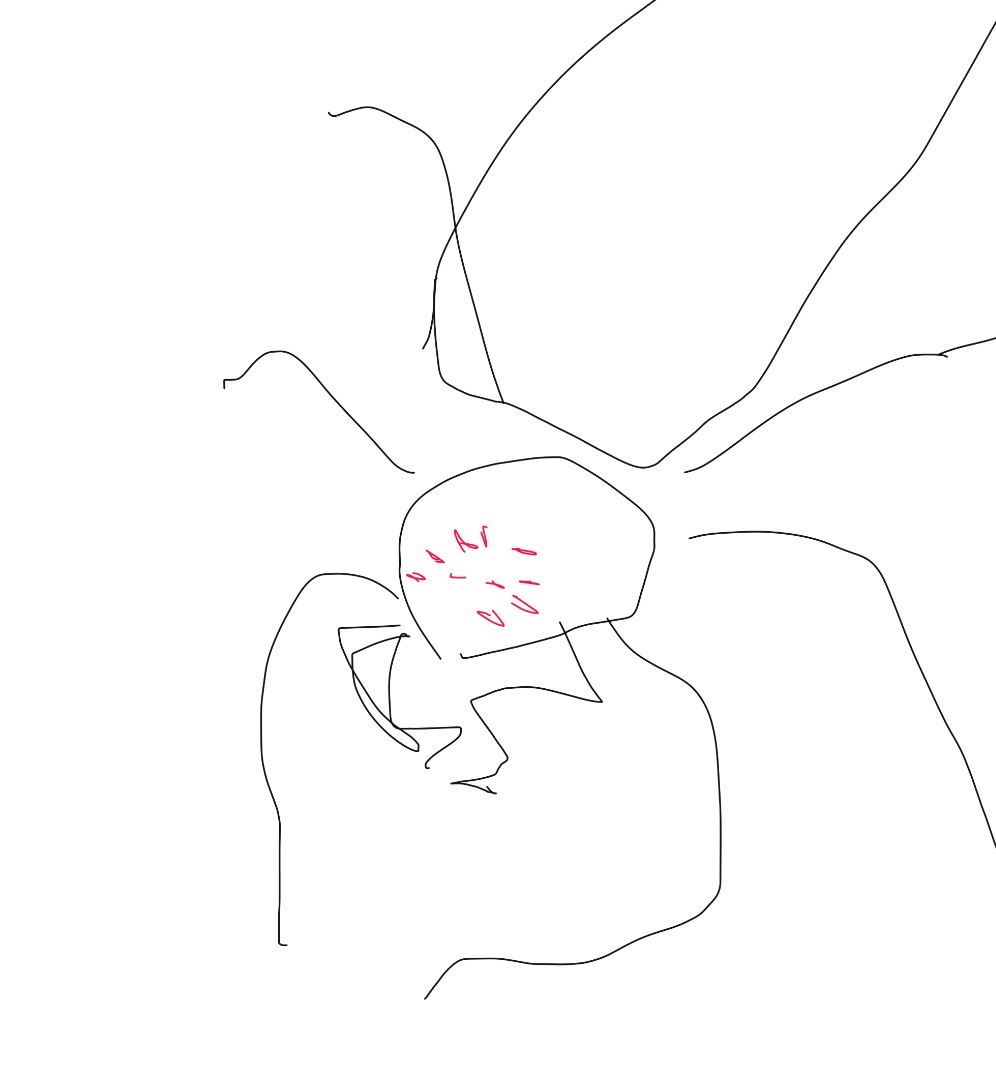 There is a spider